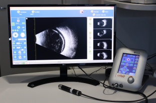 Малое изображение аппарат ультразвукового сканирования quantel aviso