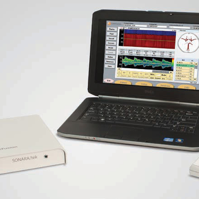 Портативный допплерограф SONARA