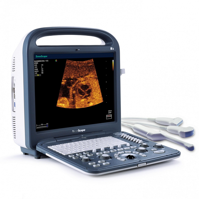 Аппарат ультразвукового сканирования SonoScape S2