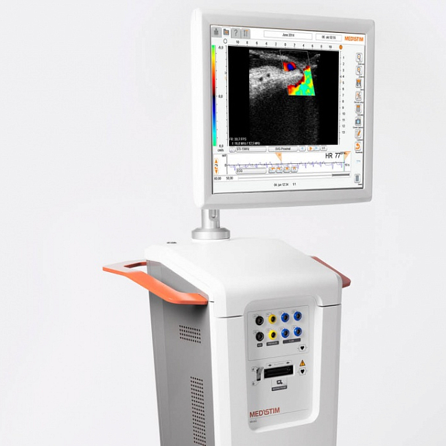 Ультразвуковой определитель оценки качества сердечного кровотока Medistim MiraQ