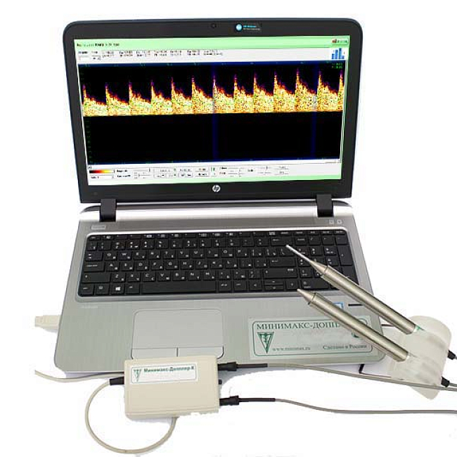 Ультразвуковой высокочастотный допплерограф Минимакс-Допплер-К