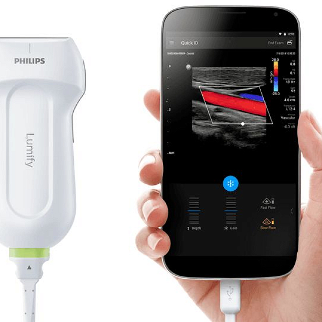 Переносная цифровая многоцелевая ультразвуковая система Philips Lumify