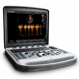 Малое изображение ультразвуковой аппарат диагностический портативный chison sonotouch 80