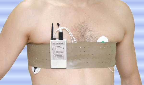 Изображение электрокардиографа Поли-Спектр-Радио-1 на груди пациента.