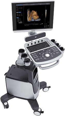 Большое изображение аппарат ультразвуковой диагностический chison qbit 7